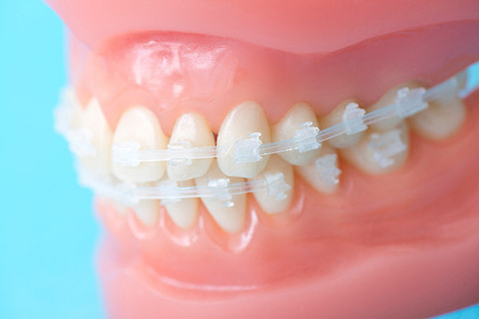 矯正歯科・矯正治療 - 上田デンタルクリニック（菖蒲池駅）