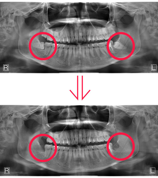 矯正歯科・矯正治療 - 上田デンタルクリニック（菖蒲池駅）