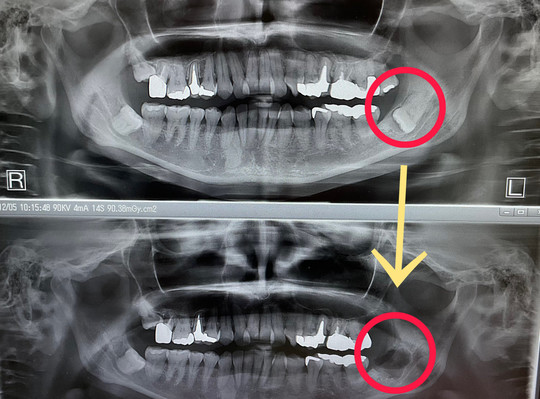 矯正歯科・矯正治療 - 上田デンタルクリニック（菖蒲池駅）